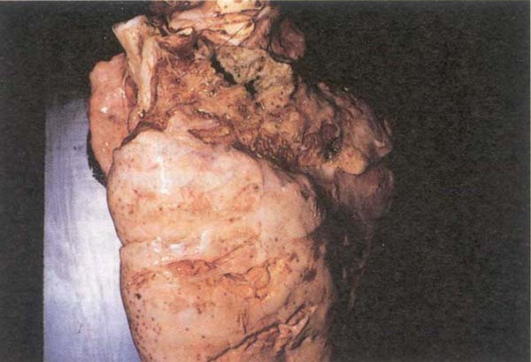 fig 128