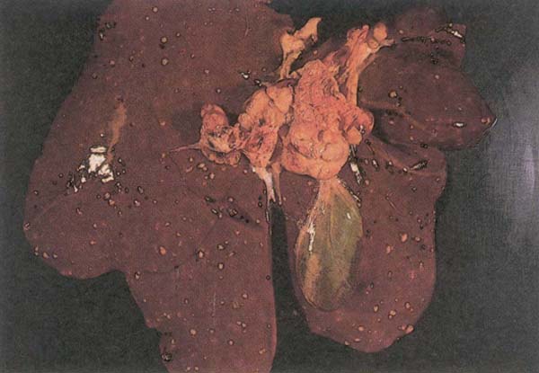 fig 133