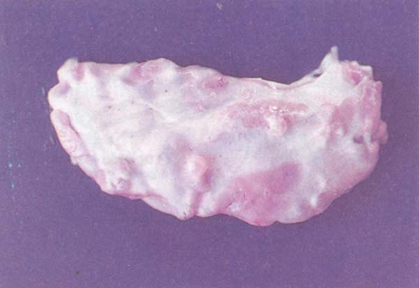 fig 142
