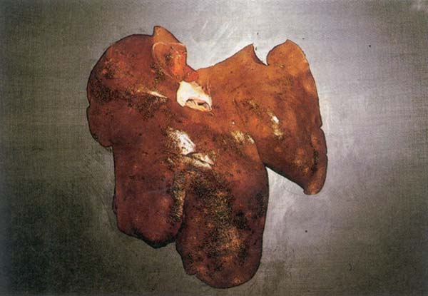 fig 144