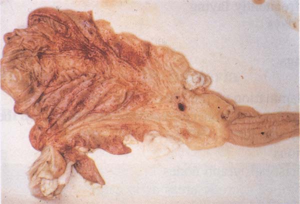 fig 161