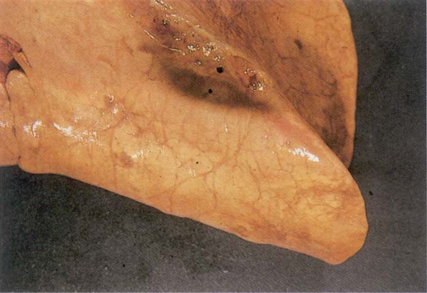 fig 170