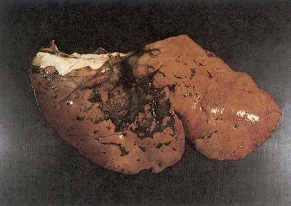 fig 171