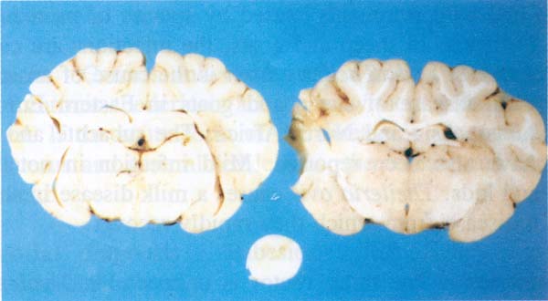 fig 176