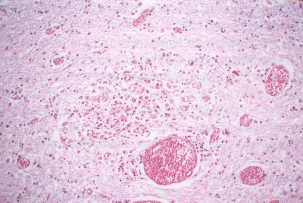 fig 177