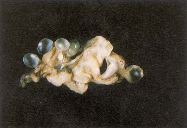 fig 212