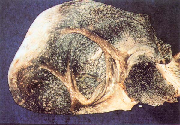 fig 58