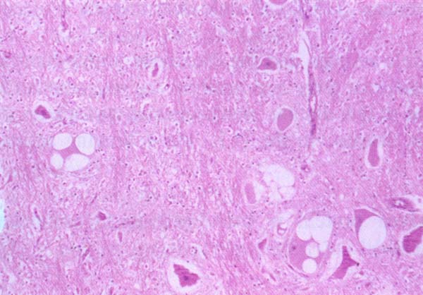 fig 62