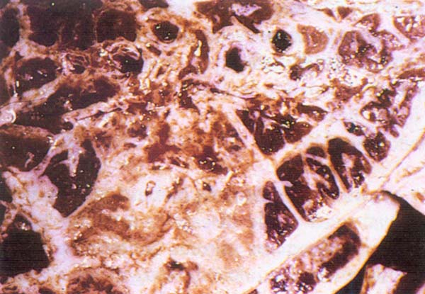 fig 65