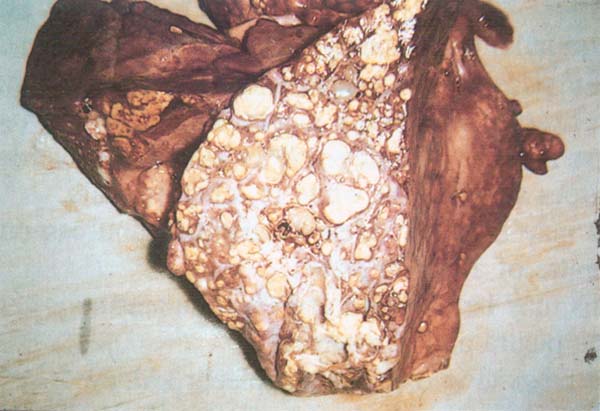 fig 69