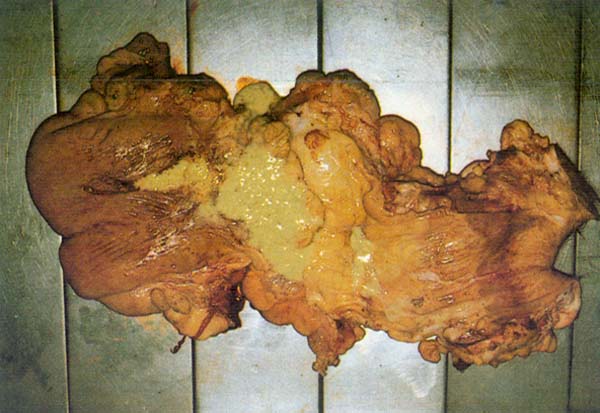 fig 81